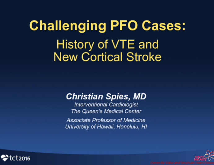 Case #5 - Introduction: History of VTE and New Cortical Stroke