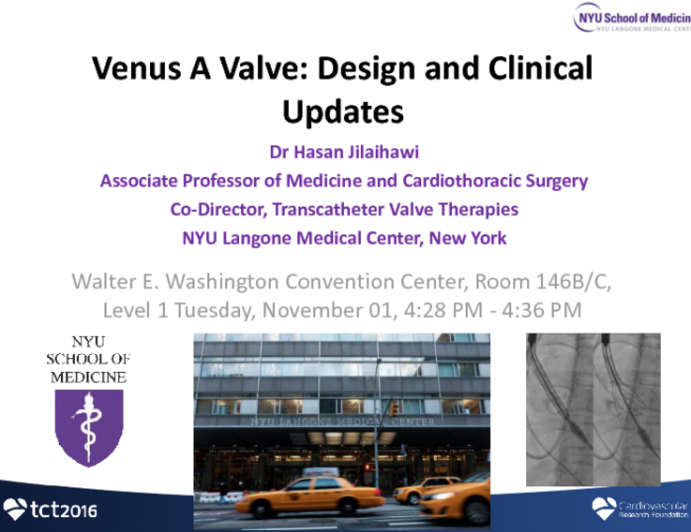 Venus A Valve: Design and Clinical Updates