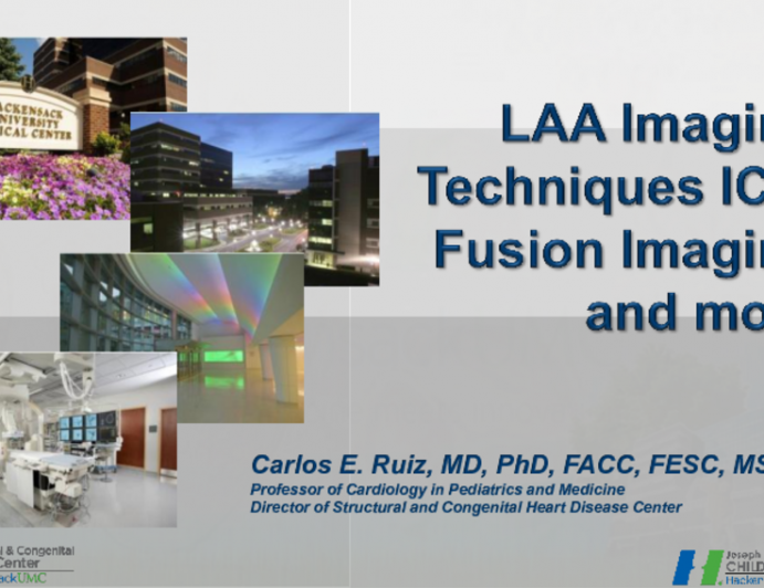 Additional LAA Imaging Techniques (Beyond TEE and CT): ICE, Fusion Imaging, and More