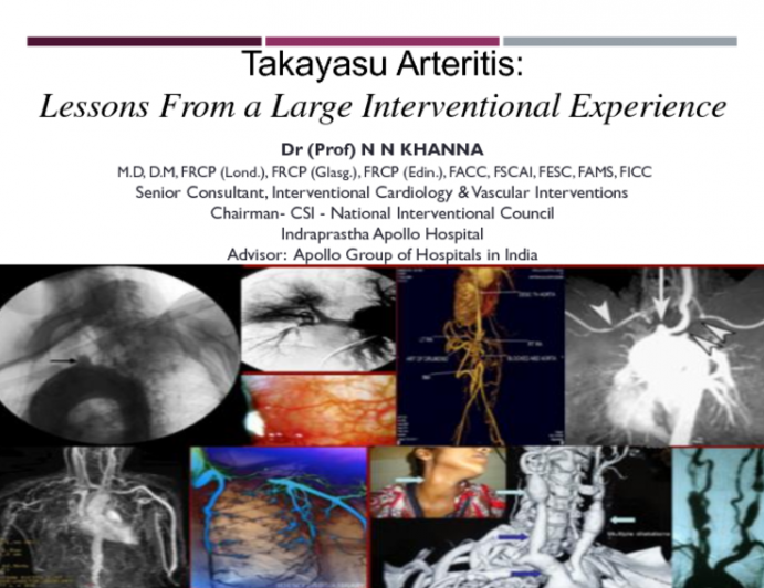Takayasu's Arteritis: Lessons From a Large Interventional