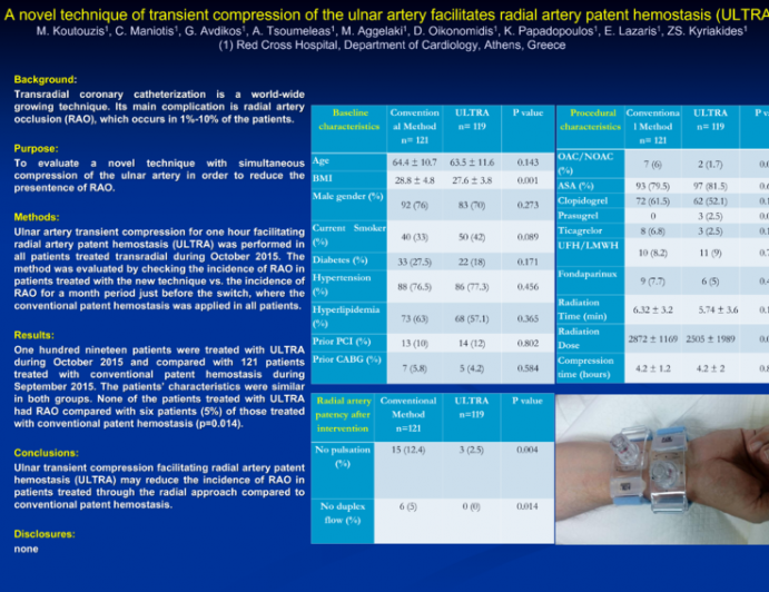 TCT 359: Ulnar Artery Transient Compression Facilitating Radial Artery patent hemostasis (ULTRA). A Novel Technique to Reduce Radial Artery Occlusion