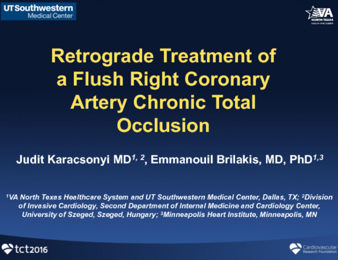 TCT 1055: Retrograde Treatment of a Flush Right Coronary Artery Chronic Total Occlusion
