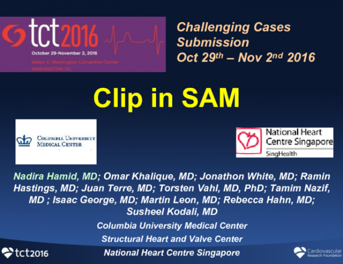 TCT 1614: Clip in SAM