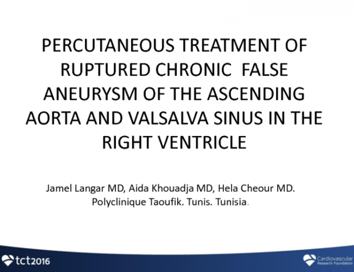 TCT 1499: Percutaneous Treatment of Ruptured Chronic False Aneurysm of the Ascending Aorta and Valsalva Sinus in the Right Ventricule