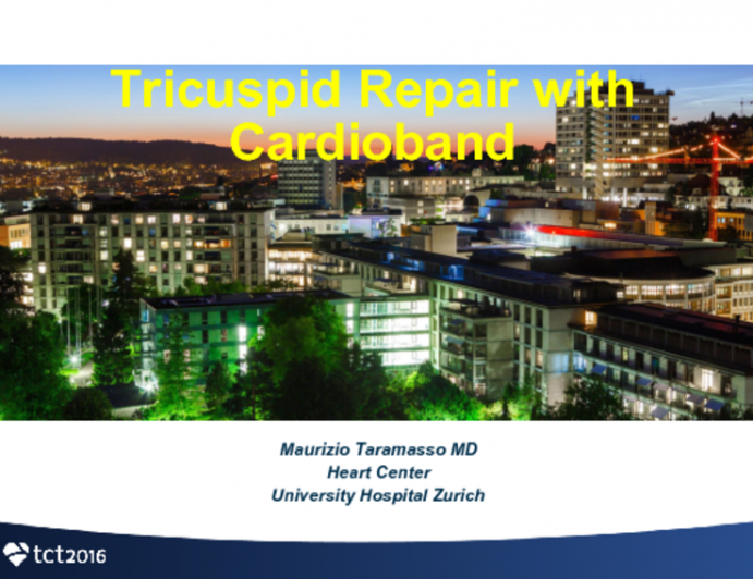 Transcatheter Tricuspid Valve Therapies 6: Cardioband TR Description, Results and a Case