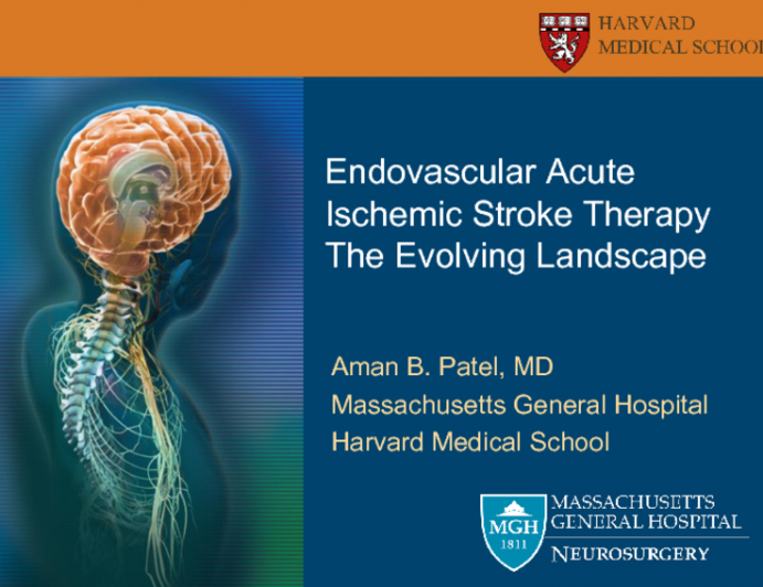 Mechanical Thrombectomy in Acute Stroke: Tips, Devices and Acute Results