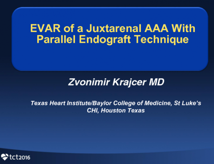 VIDEOTAPED CASE – Endovascular Repair of Juxtarenal AAA With Parallel Endograft Technique