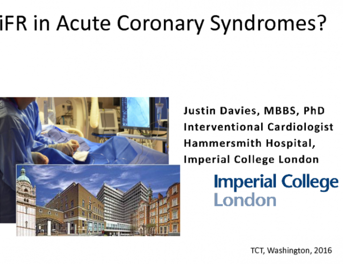 iFR in Acute Coronary Syndromes