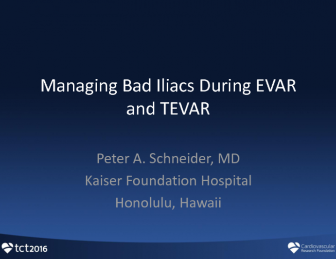 Managing Bad Iliacs During EVAR and TEVAR
