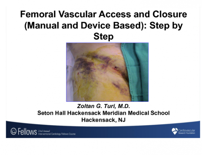 Femoral Vascular Access and Closure (Manual and Device Based): A Step-by-Step Approach