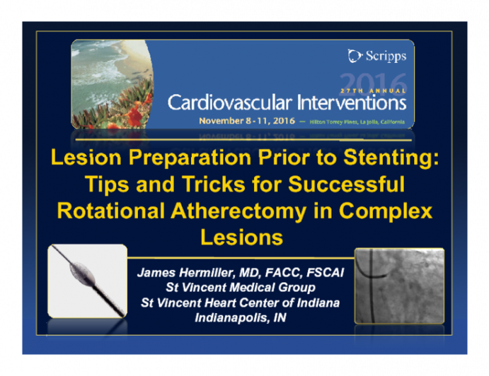 Lesion Preparation Prior to Stenting: Tips and Tricks for Successful Rotational Atherectomy in Complex Lesions