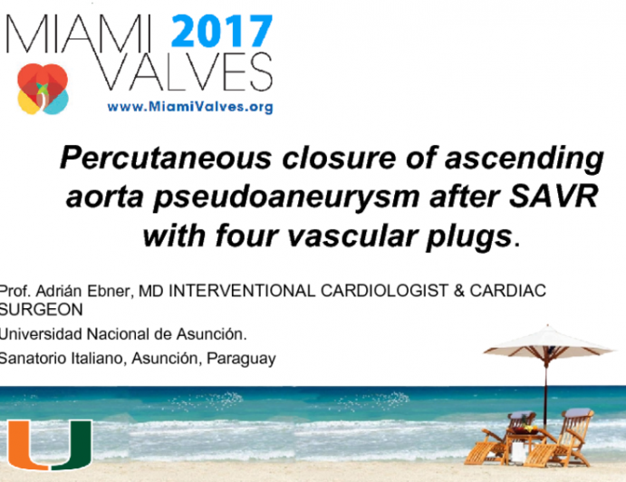 Percutaneous Closure of Ascending Aorta Pseudoaneurysm after SAVR with Four Vascular Plugs