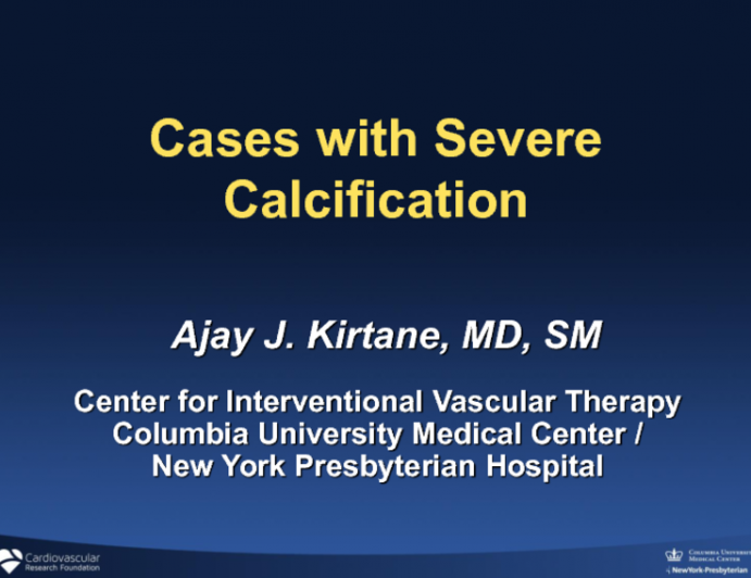 Cases with Severe Calcification