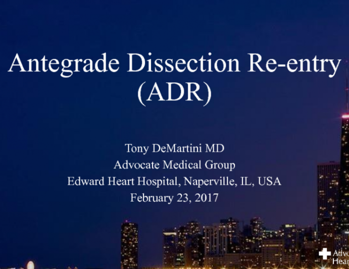 Antegrade Dissection and Re-entry
