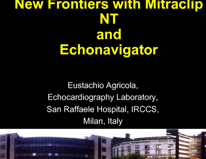 New Frontiers with Mitraclip NT and Echonavigator