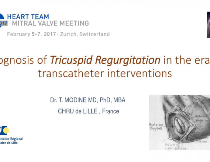 Prognosis of Tricuspid Regurgitation in the Era of Transcatheter Interventions