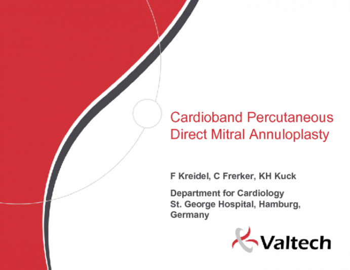 Cardioband Percutaneous Direct Mitral Annuloplasty