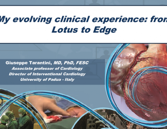 My Evolving Clinical Experience: From Lotus to Edge