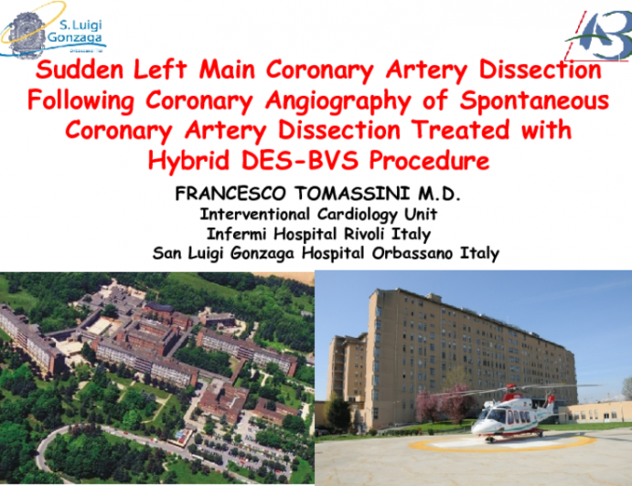 Sudden Left Main Coronary Artery Dissection Following Coronary Angiography of Spontaneous Coronary Artery Dissection Treated with  Hybrid DES-BVS Procedure