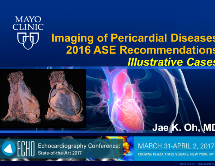 ASE Clinical Recommendations: Imaging of Patients With Pericardial Disease