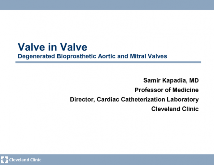 Valve-in-Valve: What You Need to Know