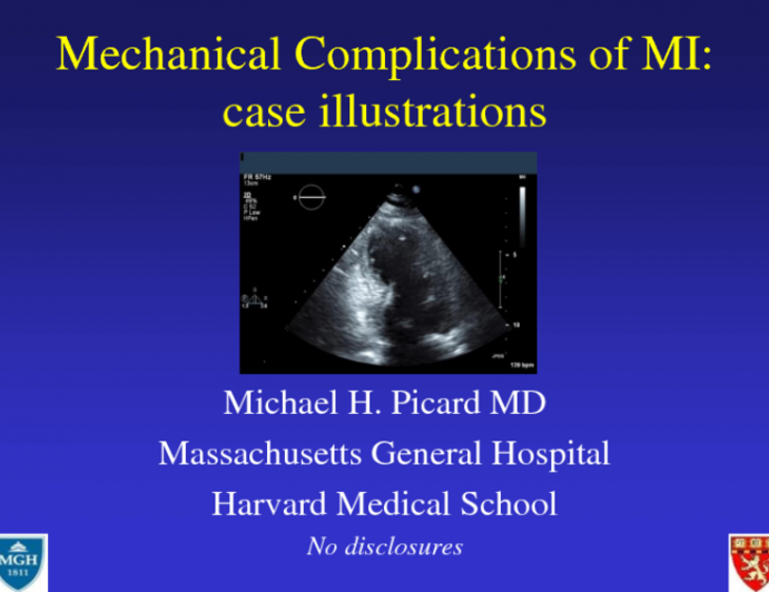 Mechanical Complications of MI: Case Ilustrations