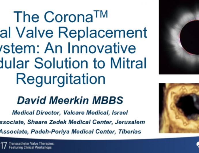 The Corona Mitral Valve Replacement System: An Innovative Modular Solution to Mitral Regurgitation