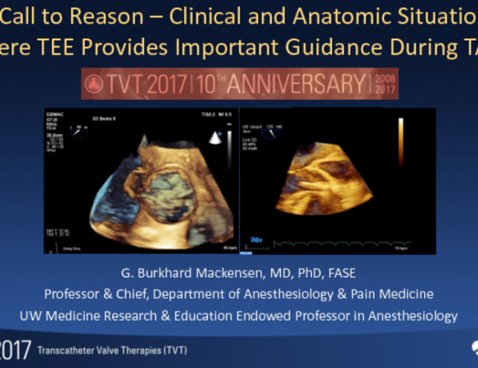 A Call to Reason – Clinical and Anatomic Situations Where TEE Provides Important Guidance During TAVR