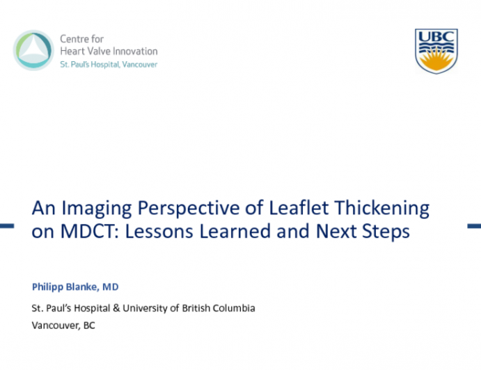 An Imaging Perspective of Leaflet Thickening on MDCT: Lessons Learned and Next Steps