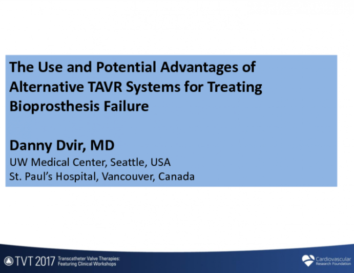 The Use and Potential Advantages of Alternative TAVR Systems for Treating Aortic Bioprosthesis Failure (Acurate, Lotus, and Portico)