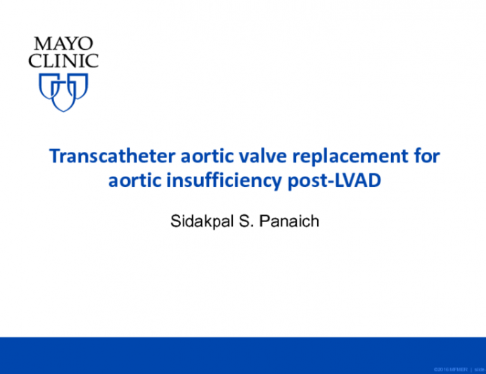 Transcatheter Aortic Valve Replacement for Aortic Insufficiency Post-left Ventricular Assist Device