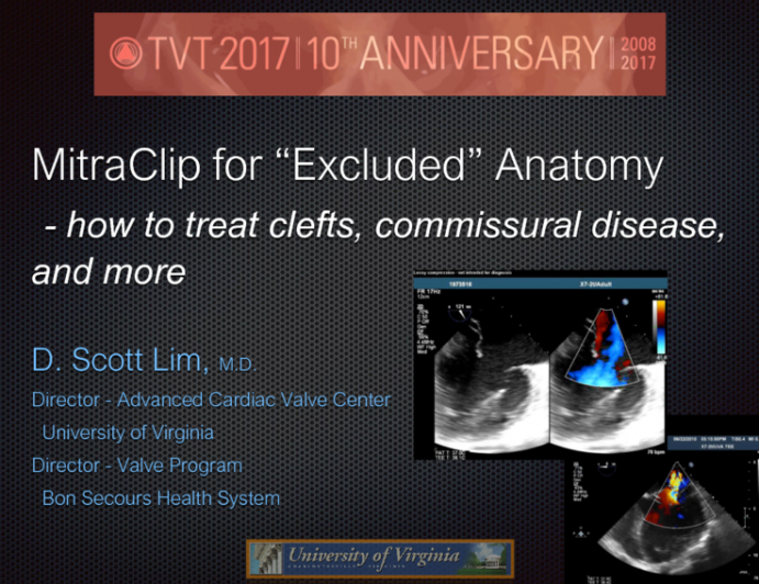 MitraClip for “Excluded” Anatomy: How to Treat Clefts, Commissural MR, and More