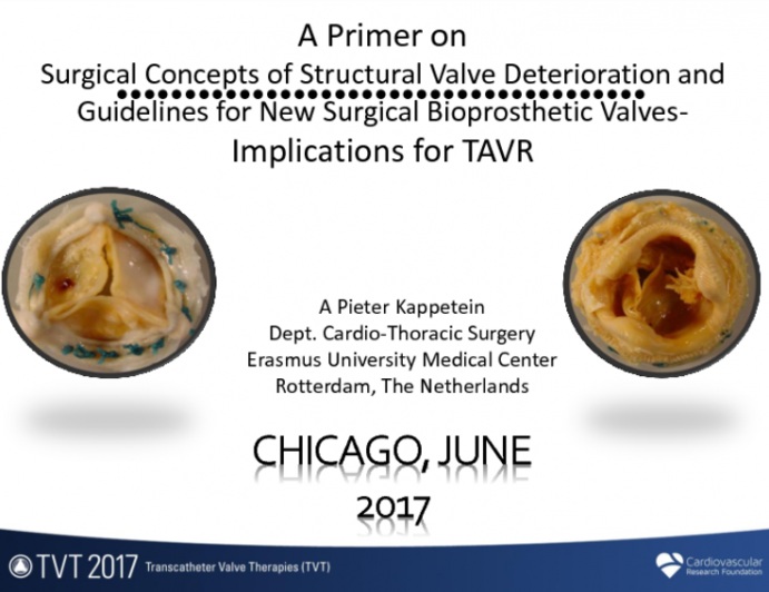 A Primer on Surgical Concepts of Structural Valve Deterioration and Guidelines for New Surgical Bioprosthetic Valves – Implications for TAVR