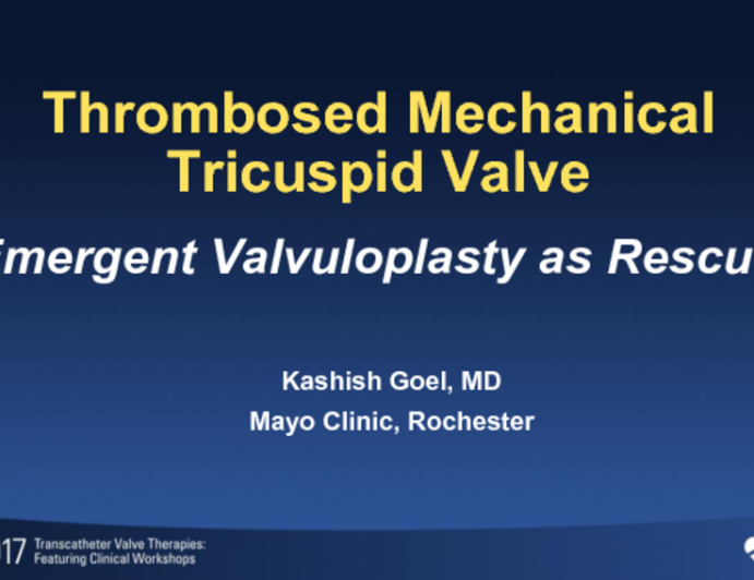 Thrombosed Mechanical Tricuspid Valve – Emergent Valvuloplasty as Rescue