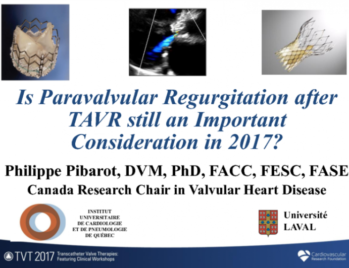 Is Para-valvular Regurgitation After TAVR Still an Important Consideration in 2017?