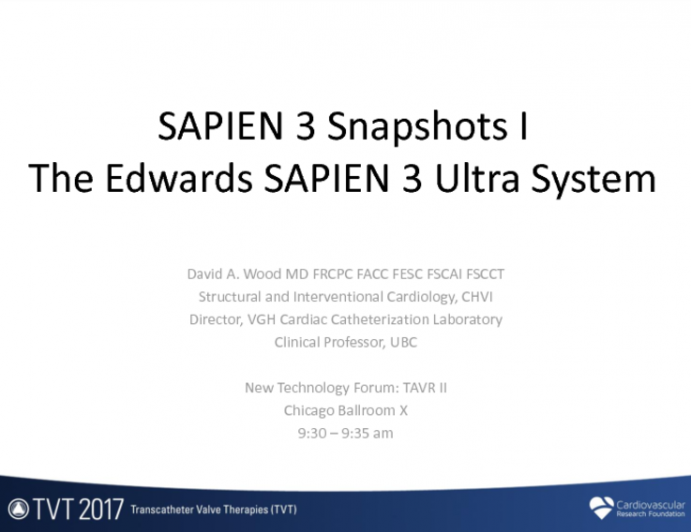 SAPIEN 3 Snapshots I - The New Sapien 3 ULTRA System