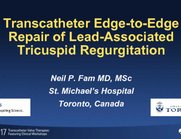 Transcatheter Edge-to-Edge Repair of Pacemaker-Associated Tricuspid Regurgitation