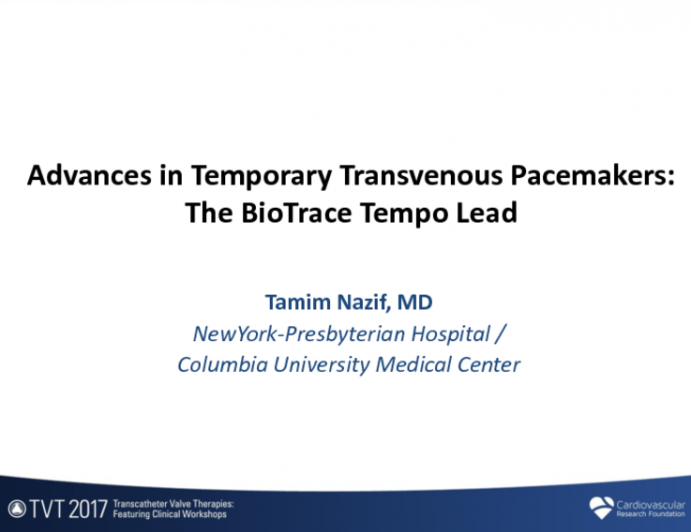 Advances in Temporary Transvenous Pacemakers: The BioTrace Tempo Lead