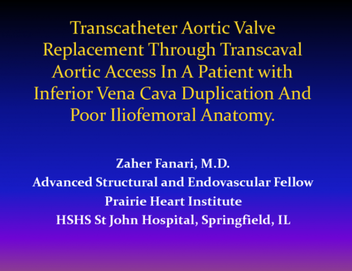 Transcatheter Aortic Valve Replacement Through Transcaval Aortic Access in a Patient With Inferior Vena Cava Duplication And Poor Iliofemoral Anatomy