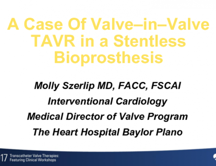 Case Presentation: A Case of Valve-in-Valve TAVR in a Stentless Bioprosthesis