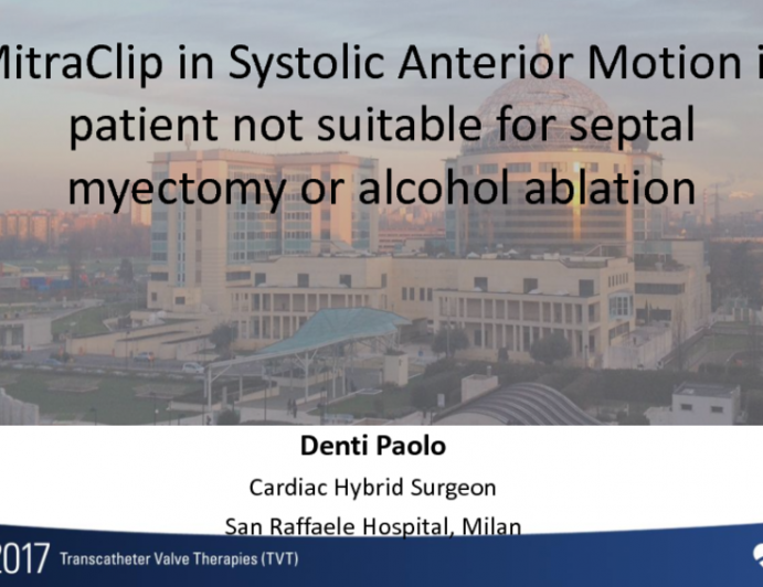 Mitraclip in Systolic Anterior Motion in Patient Not Suitable for Septal Myectomy or Alcohol Ablation