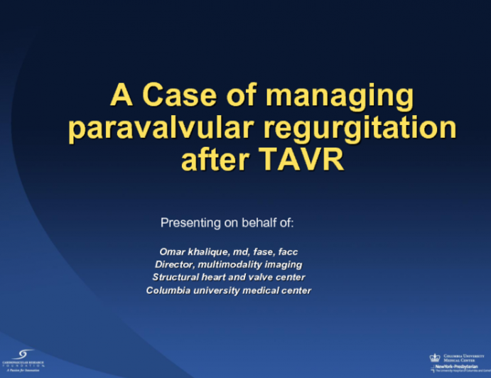 Case Tutorial #2: A Case of Managing Para-valvular Regurgitation During TAVR - Case Presentation