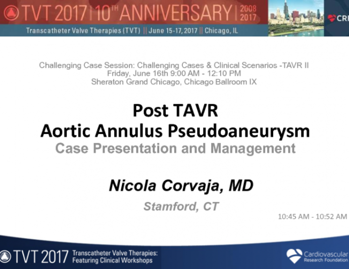 Post TAVR Aortic Annulus Pseudoaneurysm (PSA)