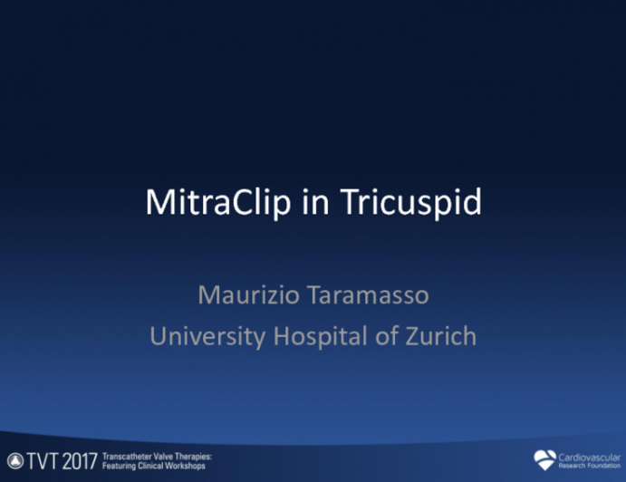 Tricuspid Technology 1: MitraClip for Tricuspid