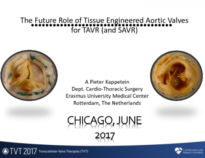 The Future Role of Tissue Engineered Aortic Valves for TAVR (and SAVR)