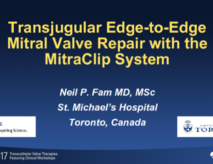 Transjugular Edge-to-Edge Mitral Valve Repair With the MitraClip System