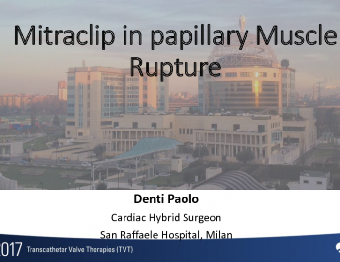 Rescue MitraClip in Papillary Muscle Rupture