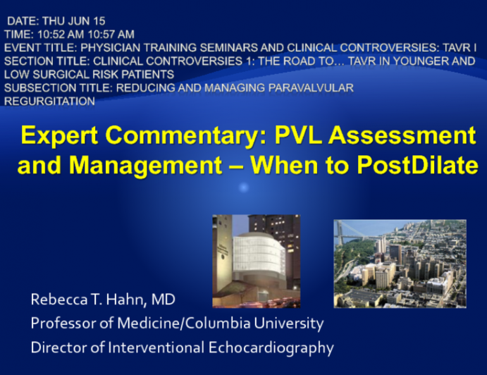 Expert Commentary: PVL Assessment and Management – When to Post-dilate