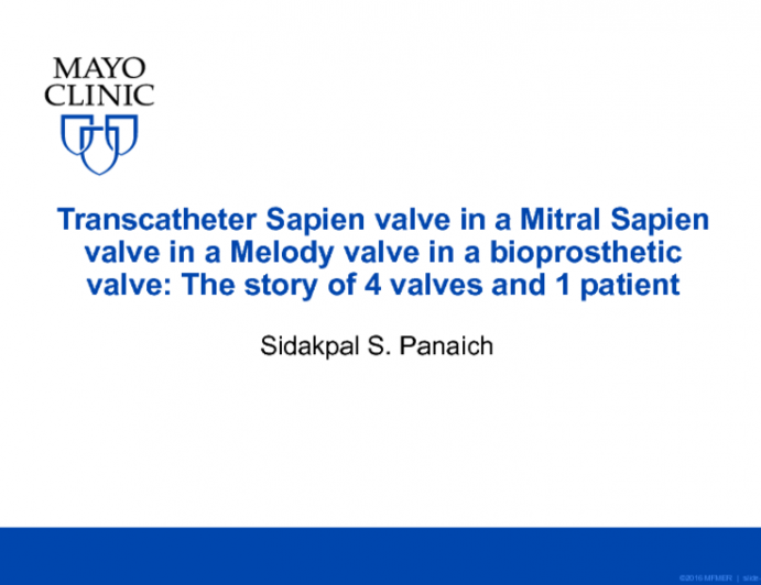 Transcatheter Sapien Valve in a Mitral Sapien Valve in a Melody Valve in a Bioprosthetic Valve: The Story of 4 Valves and 1 Patient
