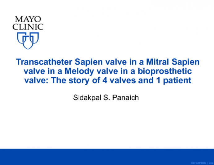 Transcatheter Sapien Valve in a Mitral Sapien Valve in a Melody Valve ...